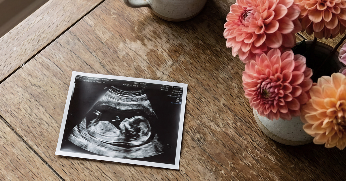 PCOS and Fertility: Can You Get Pregnant Naturally?